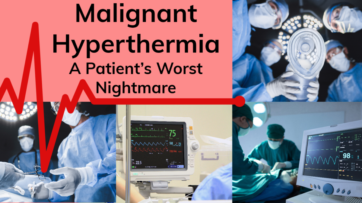 Malignant Hyperthermia Cure at Jordan Melson blog